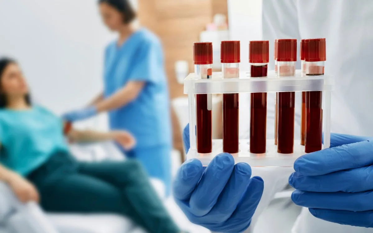 Tubos de amostra de sangue em suporte, prontos para análise